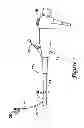 Fig. 02 - Method and apparatus for biliary access and stone retrieval
