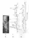 Fig. 04 - Systems and methods using nuclear magnetic resonance (NMR) spectroscopy to evaluate pain and degenerative properties of tissue