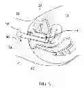 Fig. 04 - Method and device for measuring tactile profile of vagina