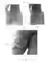 Fig. 07 - HIP SUPPORTING DEVICE