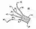 Fig. 01 - Wound dressing for finger/penis and method/system of delivery