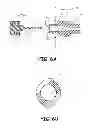 Fig. 08 - Method for delivery of antimicrobial to proximal end of catheter
