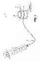 Fig. 02 - Device and method for the controlled delivery of ophthalmic solutions