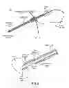 Fig. 02 - Tissue Treatment Apparatus with Interchangeable Instrument/Accessories