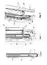 Fig. 08 - Microwave surgical device