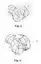 Fig. 03 - Devices and methods for performing knee arthroplasty