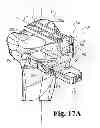 Fig. 11 - Devices and methods for performing knee arthroplasty