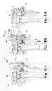 Fig. 15 - Devices and methods for performing knee arthroplasty