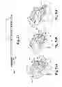 Fig. 17 - Devices and methods for performing knee arthroplasty