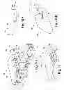 Fig. 22 - Devices and methods for performing knee arthroplasty