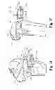Fig. 24 - Devices and methods for performing knee arthroplasty