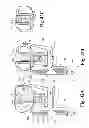 Fig. 30 - Devices and methods for performing knee arthroplasty