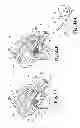 Fig. 31 - Devices and methods for performing knee arthroplasty