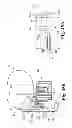 Fig. 32 - Devices and methods for performing knee arthroplasty