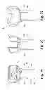 Fig. 34 - Devices and methods for performing knee arthroplasty