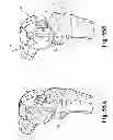 Fig. 37 - Devices and methods for performing knee arthroplasty