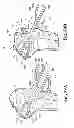 Fig. 41 - Devices and methods for performing knee arthroplasty