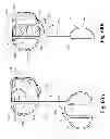 Fig. 42 - Devices and methods for performing knee arthroplasty