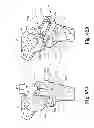 Fig. 44 - Devices and methods for performing knee arthroplasty