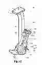 Fig. 47 - Devices and methods for performing knee arthroplasty