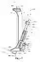 Fig. 49 - Devices and methods for performing knee arthroplasty