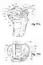 Fig. 55 - Devices and methods for performing knee arthroplasty