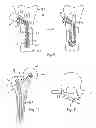 Fig. 06 - Method and device for producing an anchorage in human or animal tissue