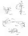 Fig. 49 - Apparatus for tissue repair