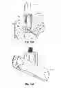 Fig. 17 - Interspinous spacers and associated methods of use and manufacture