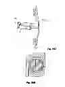 Fig. 89 - Interspinous spacers and associated methods of use and manufacture