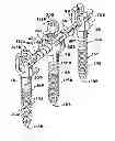 Fig. 01 - Dynamic fixation assemblies with inner core and outer coil-like member