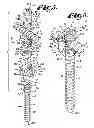 Fig. 03 - Dynamic fixation assemblies with inner core and outer coil-like member