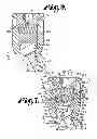Fig. 04 - Dynamic fixation assemblies with inner core and outer coil-like member