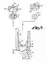 Fig. 05 - Dynamic fixation assemblies with inner core and outer coil-like member