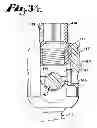 Fig. 16 - Dynamic fixation assemblies with inner core and outer coil-like member