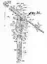 Fig. 18 - Dynamic fixation assemblies with inner core and outer coil-like member