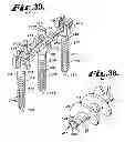 Fig. 19 - Dynamic fixation assemblies with inner core and outer coil-like member