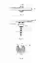 Fig. 03 - Spine stabilization system