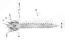 Fig. 04 - Spine stabilization system