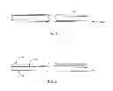 Fig. 06 - Spine stabilization system