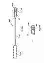 Fig. 09 - Spine stabilization system