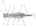 Fig. 16 - Spine stabilization system