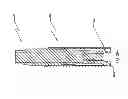 Fig. 22 - Spine stabilization system