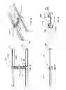 Fig. 28 - Spine stabilization system