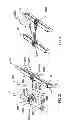 Fig. 30 - Spine stabilization system