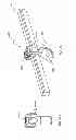 Fig. 33 - Spine stabilization system