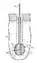 Fig. 01 - Fixation system for orthopedic devices