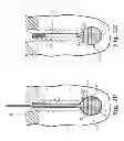Fig. 04 - Fixation system for orthopedic devices