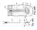 Fig. 28 - Fixation system for orthopedic devices