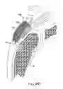 Fig. 33 - Fixation system for orthopedic devices